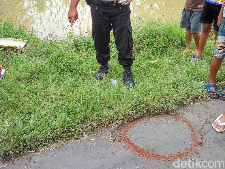 Dua Tangan Pemuda Pasuruan Ini Putus Terkena Ledakan Bondet