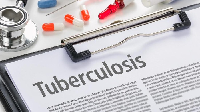 ilustrasi tuberkulosis