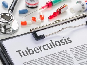 Sanitasi Buruk Picu Lonjakan Kasus TB di Tasikmalaya