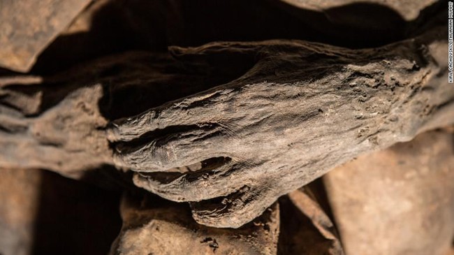 4 Penyakit Ini Diketahui Sudah Ada Sejak Zaman Kuno