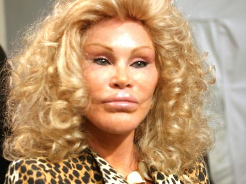 5 Selebriti dengan Operasi Plastik Termahal Mencapai Miliaran Rupiah 