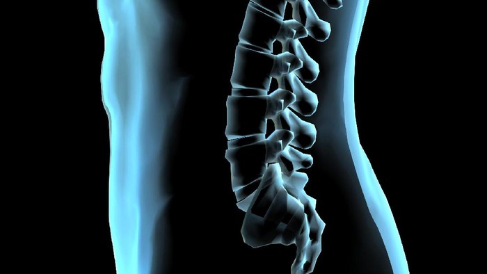 Tulang belakang memang tidak ada yang sangat lurus. (Foto: iStock) Tulang belakang memang tidak ada yang sangat lurus. (Foto: iStock)