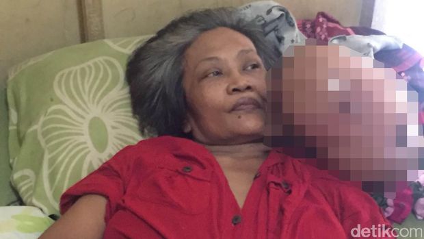 Derita Mulyani, Nenek Penderita Tumor Leher di Jakbar yang Butuh Bantuan