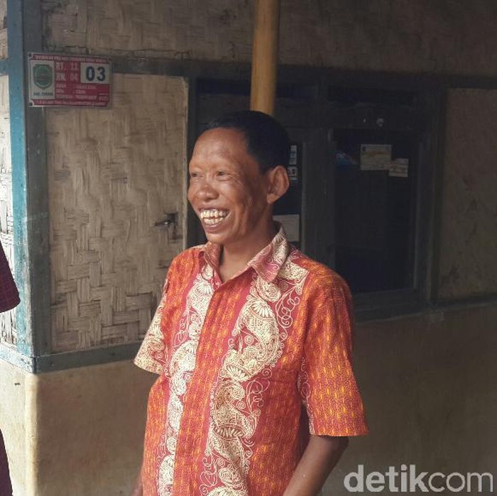 Kisah Wahyudi Tetap Tegar Menghadapi Kusta dan Pandangan Negatif