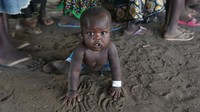 Malnutrisi masih menjadi di kalangan pengungsi khususnya anak-anak. REUTERS/James Akena.