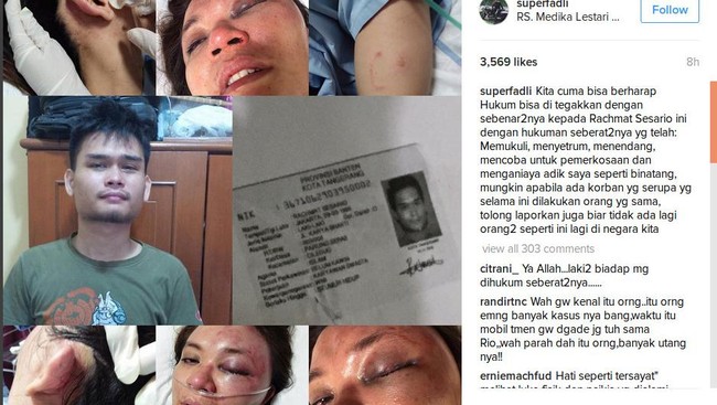 Derita Adik Presenter Fadlan-Fadli: Dianiaya, Disetrum, dan Nyaris Diperkosa