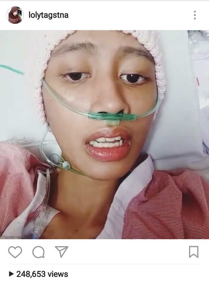 Tolong! Pasien Kanker ini Minta Bantuan Cari Obat untuk Kemoterapi