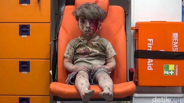 Anak-anak ini Jadi Simbol Kejinya Perang di Suriah