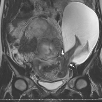 The New England Journal of Medicine