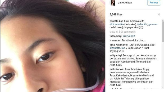 Ini Ungkapan Sedih Anet atas Kepergian Ayah dan Saudaranya