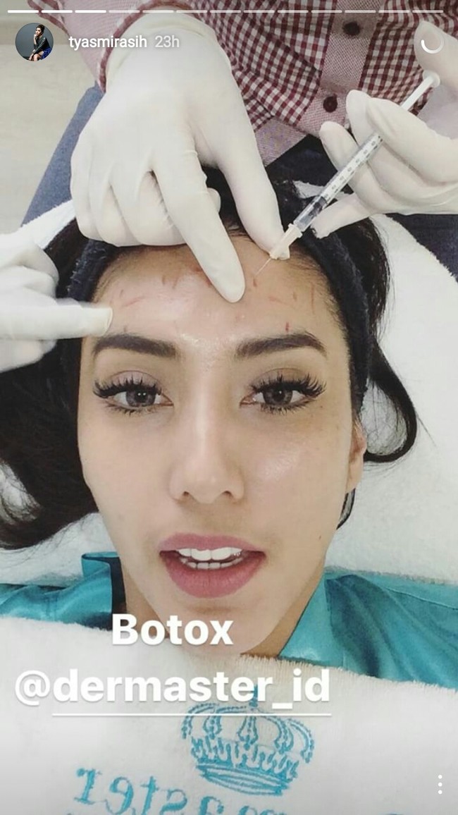Tyas Mirasih juga melakukan botox. Tampak dokter kecantikan menyuntikan cairan botox di dahi Tyas Mirasih. Foto: Instagram Tyas Mirasih