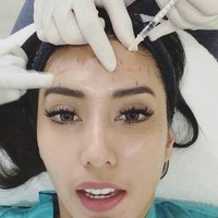 Tyas Mirasih juga melakukan botox. Tampak dokter kecantikan menyuntikan cairan botox di dahi Tyas Mirasih. Foto: Instagram Tyas Mirasih