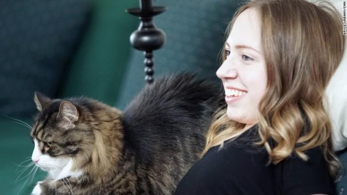 Kisah Perempuan Muda yang Tubuhnya Terancam Membatu