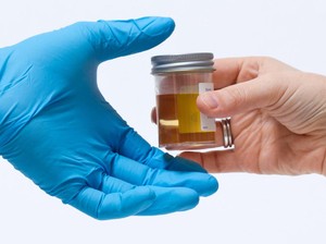 2 Kepling di Medan Terseret Narkoba, DPRD Minta Pemkot Lakukan Tes Urine