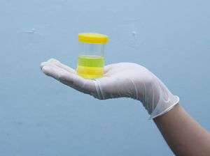 Saat Calon Pengantin di Tanjungbalai Wajib Tes Urine Sebelum Nikah