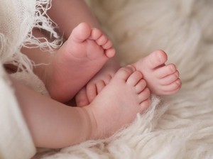 Fakta-fakta Bayi Kembar Siam Langka, Sekilas Seperti Punya 6 Kaki