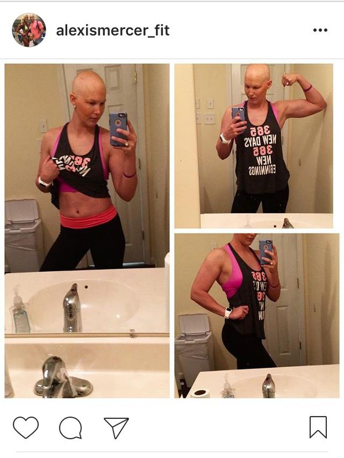 Kena Kanker dan Jalani Kemo Tak Halangi Wanita Ini Lakukan Bodybuilding