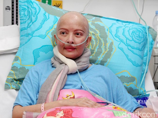 Belajar dari Pengalaman Yana Zein yang Berjuang Lawan Kanker Payudara
