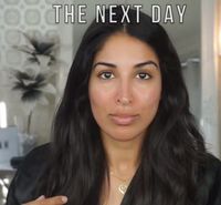 Vlogger Kecantikan Pakai Wasabi untuk Kempeskan Jerawat, Berhasilkah?