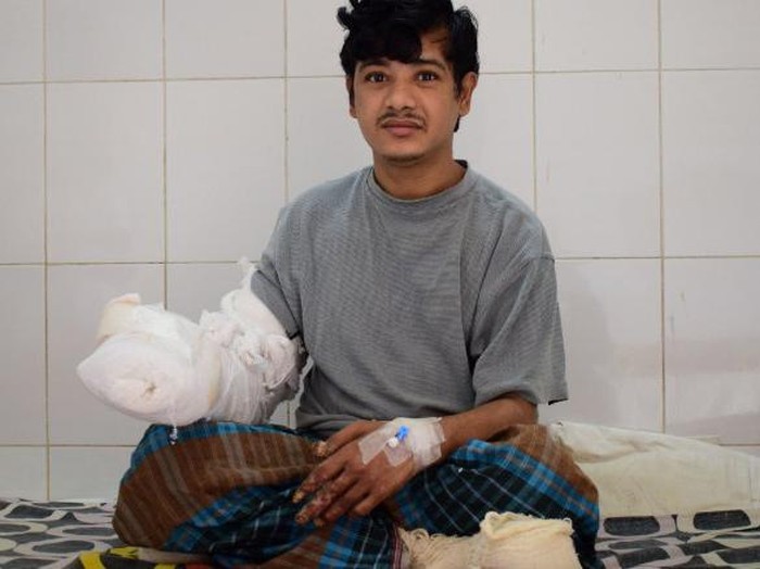 Penjelasan Ilmiah Mengapa Bisa Muncul Fenomena Manusia Pohon