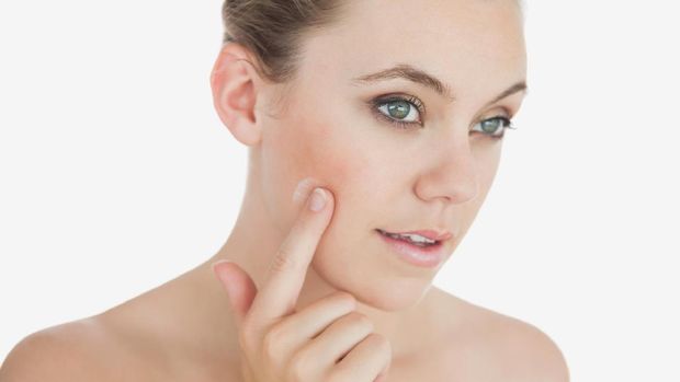 Bisakah Psoriasis Menyebar ke Wajah Seperti Dialami Kim Kardashian?