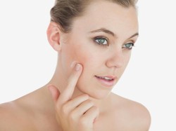 Mengenal Perawatan Chemical Peel dan Manfaatnya untuk Kulit Wajah