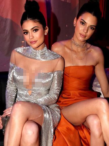 Foto: Ketika Kylie Jenner Pamer Bekas Luka di Pahanya 