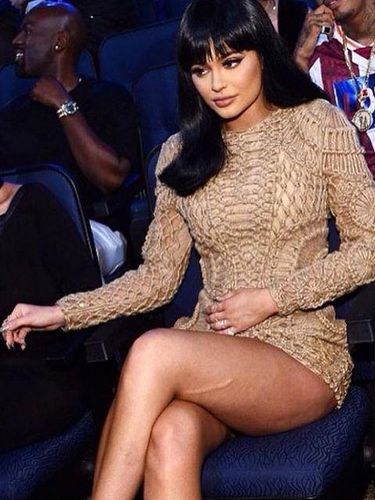 Foto: Ketika Kylie Jenner Pamer Bekas Luka di Pahanya 