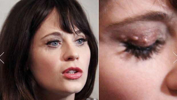 Kocak, Ini Foto-foto Memalukan Selebriti 