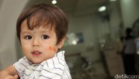 Tampak bekas coretan di pipinya setelah bermain tinta di sekolahnya. Hanif Hawari/detikHOT
