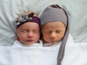 Kisah Sedih di Balik Foto Mempesona Sepasang Bayi Kembar