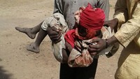 Seorang pria tengah mengevakuasi seorang bocah setelah serangan terjadi. REUTERS/Medecins Sans Frontieres (MSF).