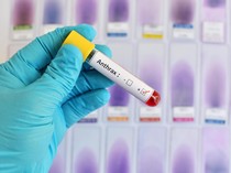 2 Ternak di Girisubo Gunungkidul Mati Mendadak, Diduga Kena Antraks