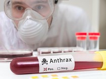 1 Sapi di Gunungkidul Mati Terpapar Antraks Dibuang ke Luweng