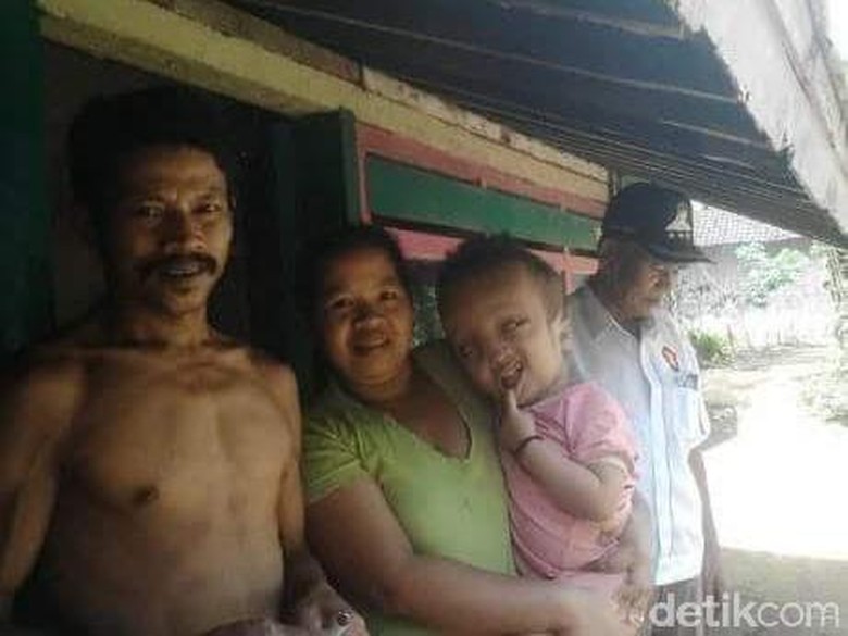 Tak Kunjung Dioperasi, Penderita Hydrocephalus di Jember Meninggal Tak Kunjung Dioperasi, Penderita Hydrocephalus di Jember Meninggal