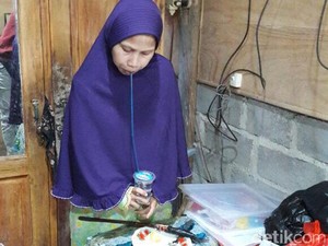Kisah Perjuangan Hidup Sulami Manusia Kayu Sejak Kelas 4 SD