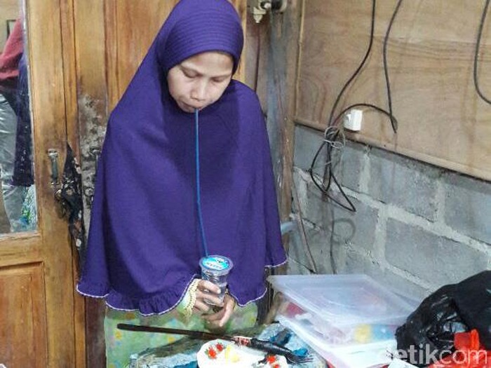 Sulami, warga Selorejo RT 31/11 Mojokerto, Kedawung, Sragen yang mengalami kelainan sehingga sekujur tubuhnya kaku