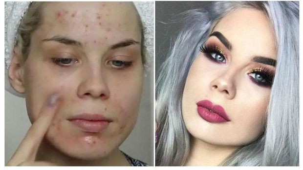 Foto: Membandingkan Wajah <i>Beauty Vlogger</i> Saat Pakai dan Tidak Pakai Makeup