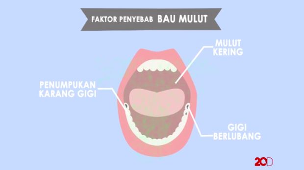 Video: Sudah Gosok Gigi, Kok Mulut Masih Bau Kenapa Ya?