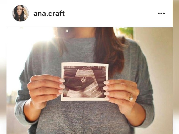 Wah! Janin Ini Bikin Tanda Peace Saat Di-USG