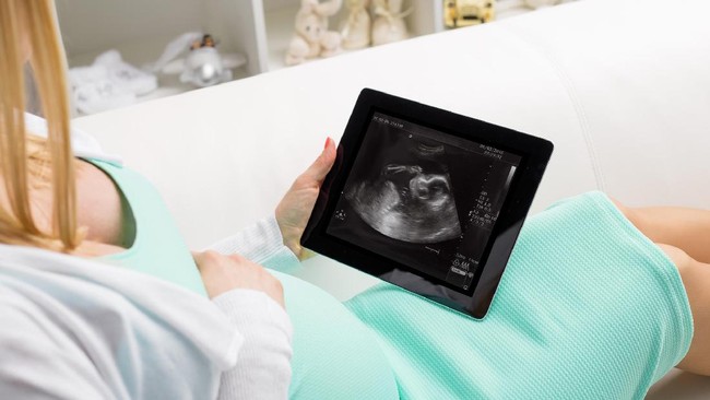 Padahal Mitos, 7 Pantangan Saat Hamil Ini Masih Dipercaya