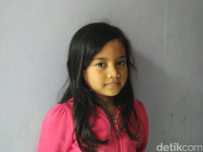 Seekor Lintah Hidup di Hidung Bocah Asal Depok Selama Satu Bulan