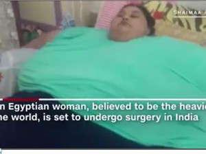 Bobot 500 Kg Bikin Perempuan Ini Bertahun-tahun Tak Leluasa Gerak