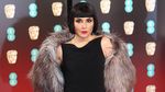 Gaya Para Aktris Cantik di BAFTA 2017