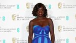 Gaya Para Aktris Cantik di BAFTA 2017