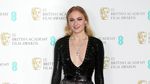 Gaya Para Aktris Cantik di BAFTA 2017