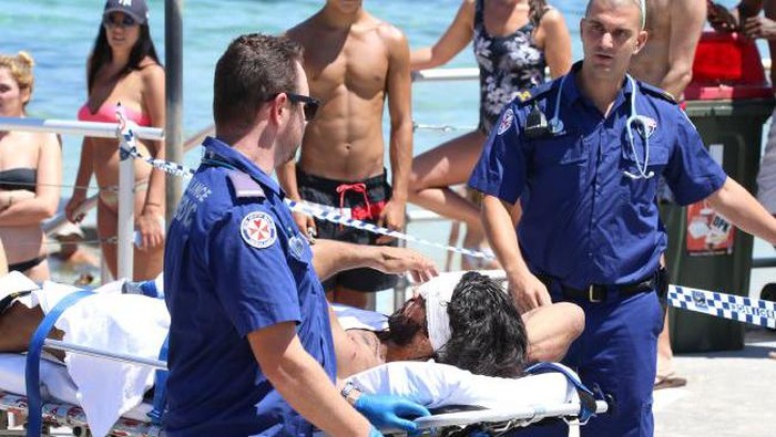 Mengerikan! Seorang Pria Diserang di Pantai Bondi Siang Hari Bolong