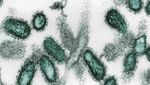 Penampakan Virus Flu Burung Lewat Mikroskop