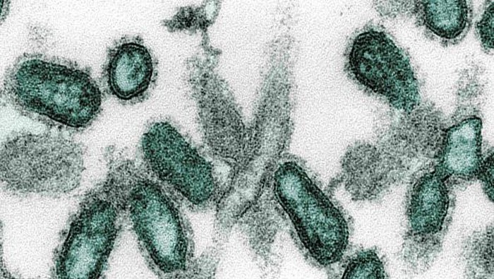 virus H1N1 Virus H1N1, Responsible For The Deadly Pandemy Of Spanish Flu In 1918 Colorized Tem. Succeded In Rebuilding This Virus From An Avian Influenza Transmissible Between Human Beings. His Study Will Permit To Understand Better The Modes Of Transmission Of The Virus H5N1 Of The Current Avian Influenza Virus. Spanish Flu Virus, As All Influenza A Viruses, Is A Pleiomorphic Virus, Which Means That It Can Present Under Different Forms According To The Conditions. The Virus H1N1 Can Present Under A Spherical Or Filamentous Aspect. Spanish Flu Virus H1N1 > Influenzavirus A > Influenzavirus > Orthomyxoviridae > Rna Virus > Virus. This Transmission Electron Micrograph Tem Of An Ultra Thin Specimen Revealed Some Of The Ultrastructural Morphologic Features Seen In 1918 Influenza Virus Virions. The Prominent Surface Projections On The Virions Are Composed Of Either The Hemagglutinin, Or Neuraminidase Type Of Glycoproteins. Composed Of What Looked Like Dots Or Tubules, Was A Dense Envelope Known As A ?Capsid?, Which Surrounded Each Virion?S Nucleic Acid Constituents. What Is Influenza Also Called Flu?The Flu Is A Contagious Respiratory Illness Caused By Influenza Viruses. It Can Cause Mild To Severe Illness, And At Times Can Lead To Death. The Best Way To Prevent This Illness Is By Getting A Flu Vaccination Each Fall. Every Year In The United States, On Average: 5% To 20% Of The Population Gets The Flu; More Than 200,000 People Are Hospitalized From Flu Complications, And; About 36,000 People Die From Flu. Some People, Such As Older People, Young Children, And People With Certain Health Conditions, Are At High Risk For Serious Flu Complications. (Photo By BSIP/UIG Via Getty Images)