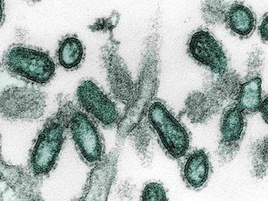 9 Virus Mematikan di Dunia, Ada yang Berpotensi Wabah di Indonesia